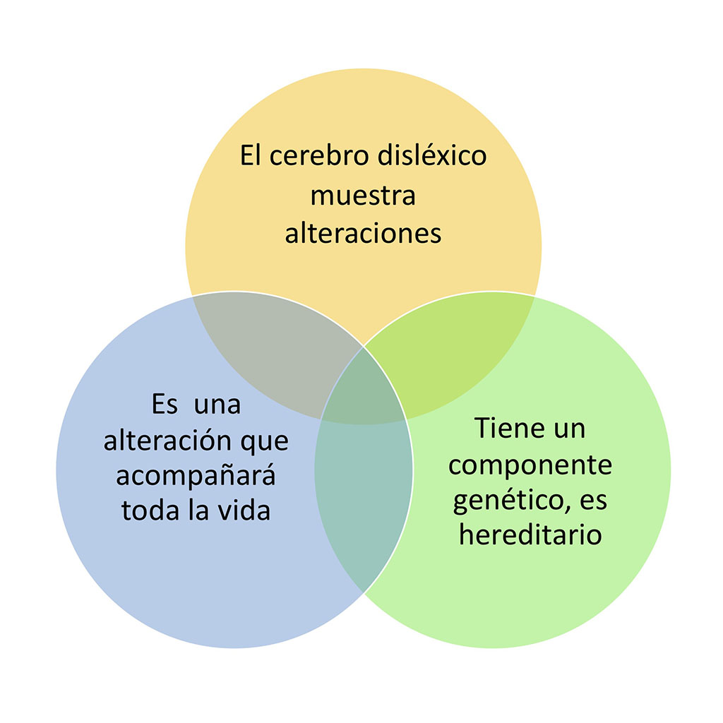 Cursos online - Dislexia - Doménica López Olac Cursos online - Dislexia - Doménica López Olac